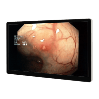 Medical Display